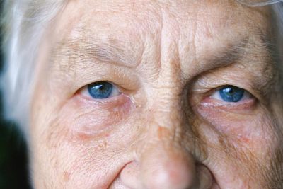 close up photo of woman's blue eyes, showing eyesight development as we age. Southern Vitreoretinal Associates Blog